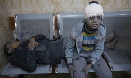 Bambini palestinesi feriti attendono di essere curati all'ospedale dei martiri di al-Aqsa a Deir al-Balah.