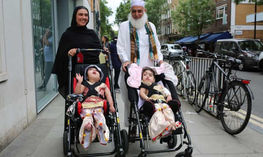 Conjoined Twin Girls Separated In London After 50 Hours Of Surgery Health The Guardian Conjoined Twin Girls Separated In London After 50 Hours Of Surgery Health The Guardian