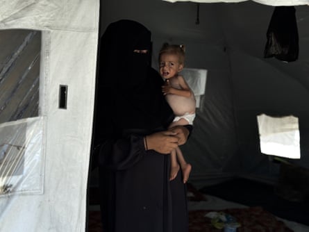 A mother holding her malnourished baby.