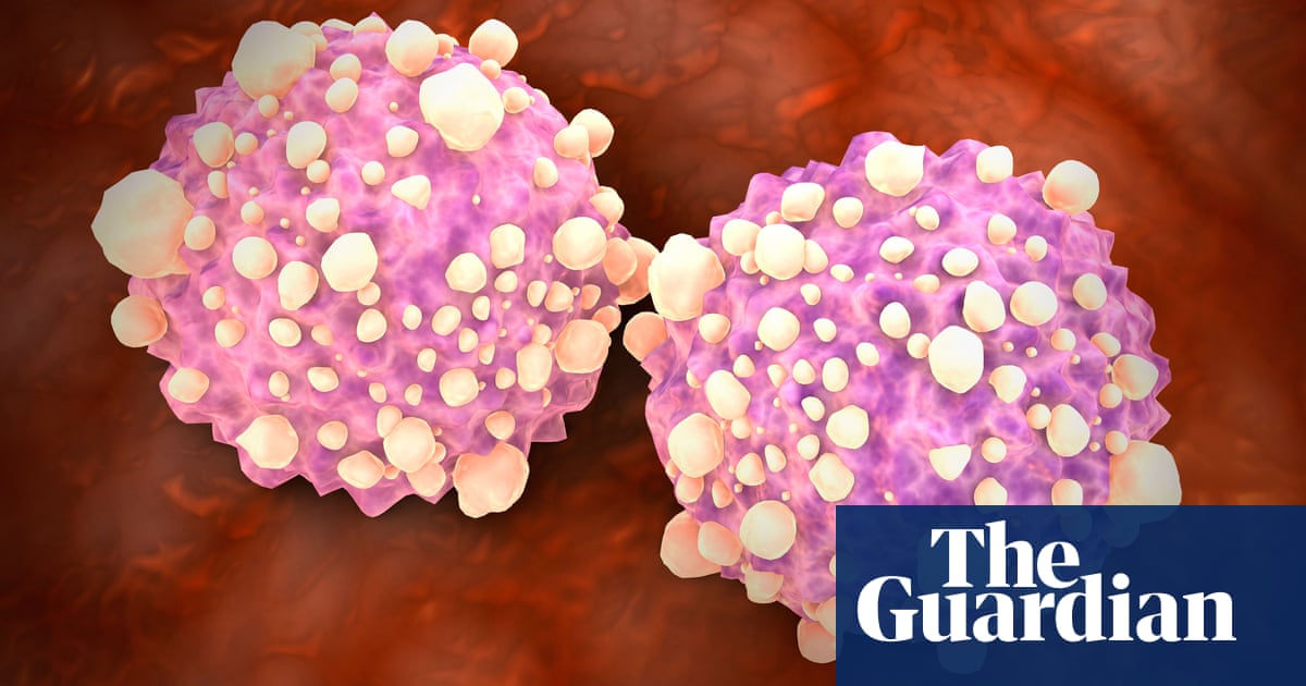 New blood test can detect 50 types of cancer