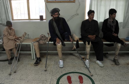 Afghan amputees sit on a bench with their prosthetic legs at a hospital in Afghanistan.