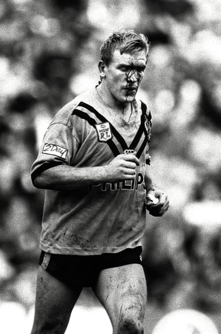 Garry Jack, pictured after a brawl with Roberts in 1991.