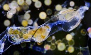 This microscopic arrow worm has eaten a blue plastic fibre that is blocking the passage of food along its gut. 