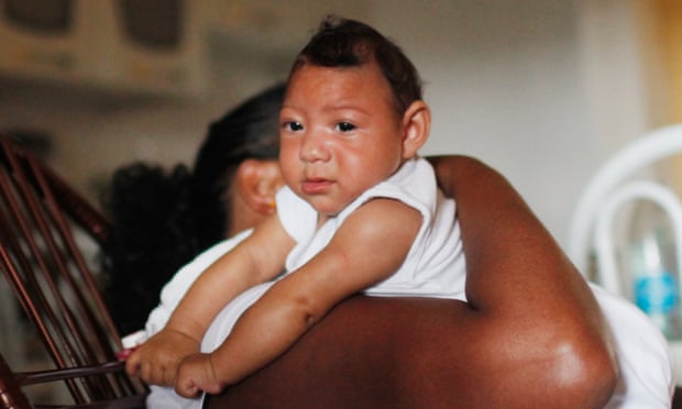 Nadja Cristina Gomes Bezerra holds her three-month-old daughter, Alice Vitoria, who has microcephaly.