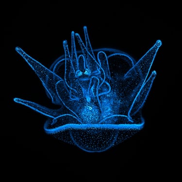 A 20-day-old sea urchin larva with blue fluorescent nuclei