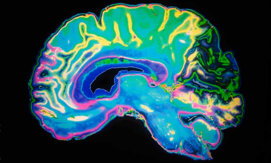 Artificially Coloured MRI Scan Of Human Brain.