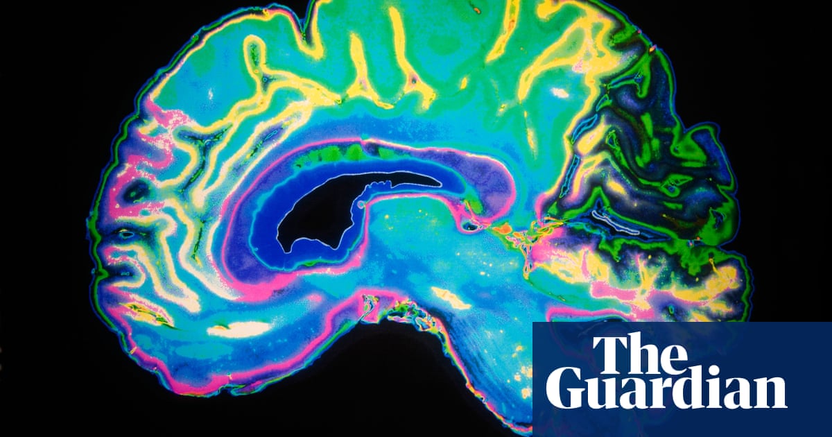 Crossword blog: the truth about crosswords and dementia ...