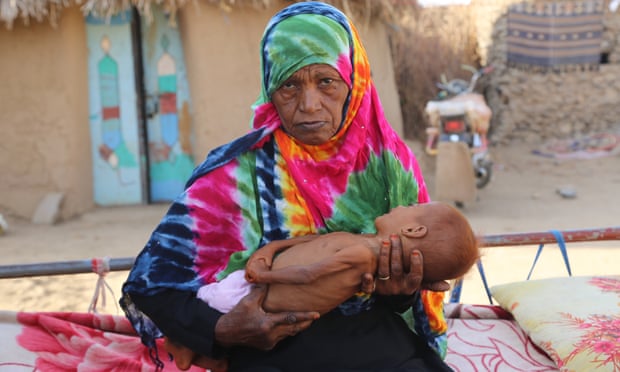 Ghaleb Mashn holds her 11-month-old son, Radad, in al-Hajb village, Yemen