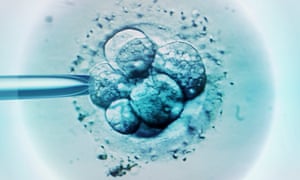 Embryo selection for IVF light micrograph