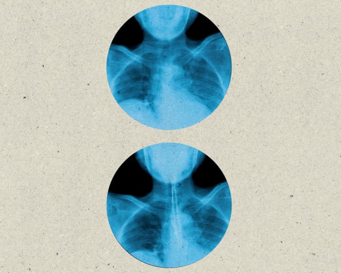 Swallowing correctly can save your life – are you doing it right?