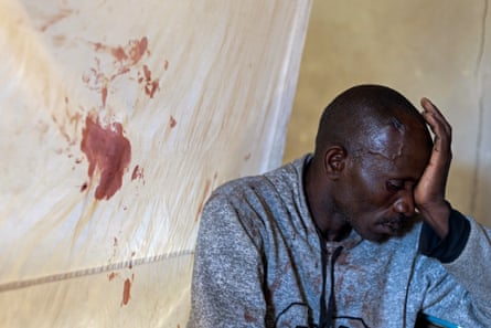 A man sits holding his head looking away from the camera with a bloodstained white sheet in the background