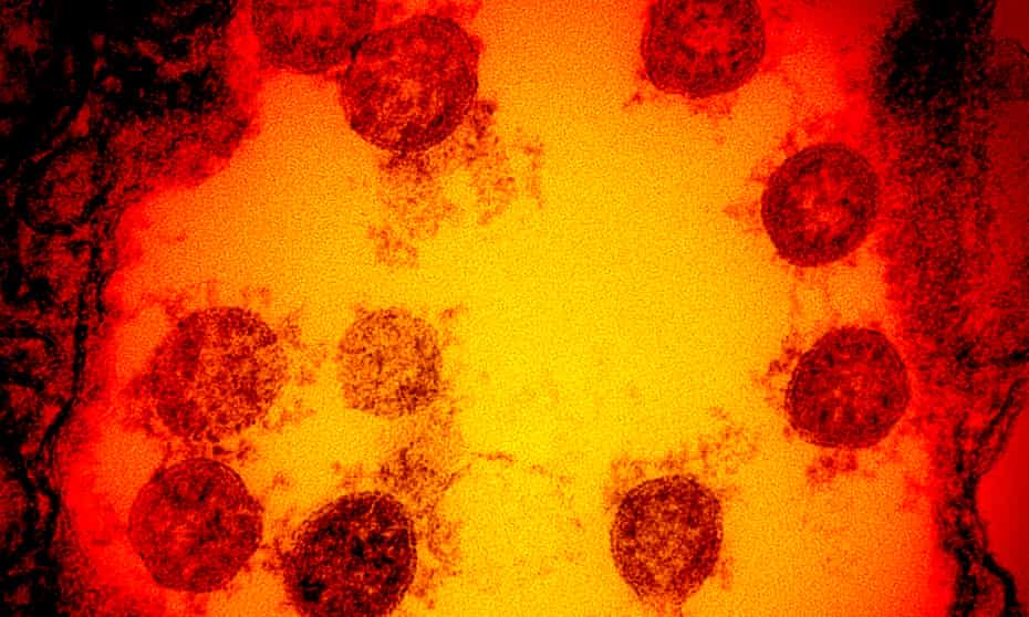 A electron micrograph of the coronavirus