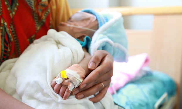 A mother holds a malnourished baby in a hospital