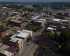 Ohio woman sues hospital for allegedly amputating wrong leg during surgery