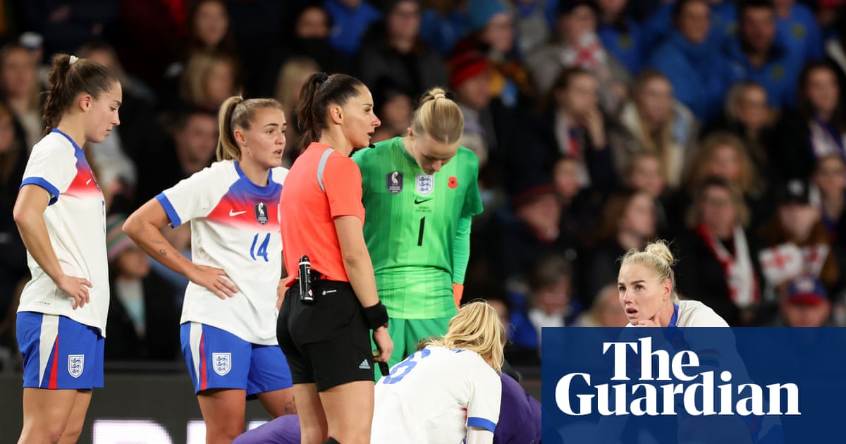 Could the notch' be key to understanding ACL injuries in women's football?