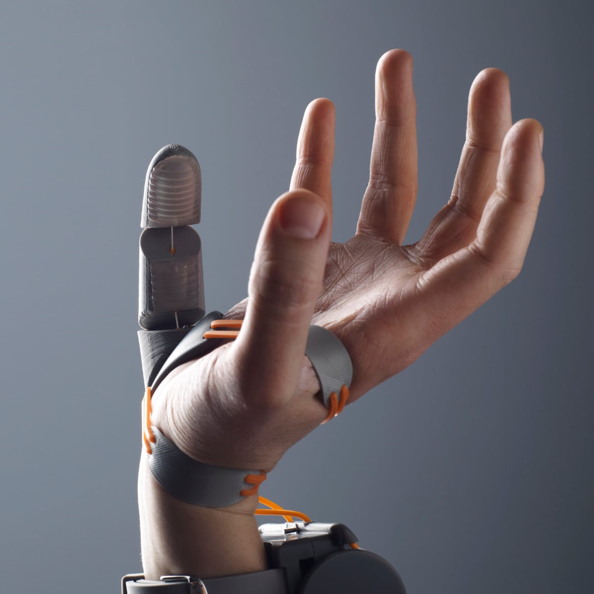 Prosthetic Hand Science Project