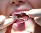 UK competition watchdog to review private dentistry market after prices rise by 23%