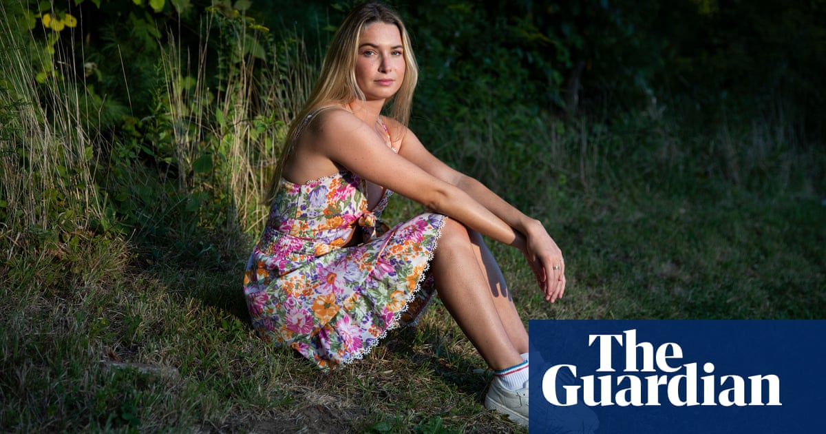 Experience: I'm allergic to nearly everything