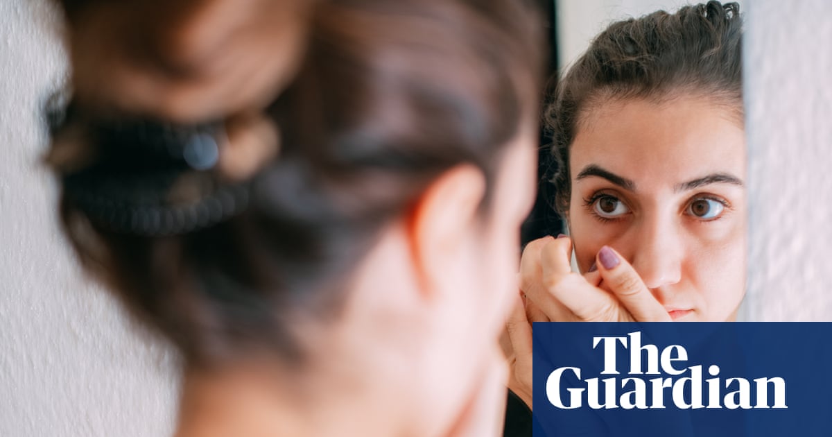 ‘Ferritin face’: are social media claims about iron deficiency fact – or fiction? | Medical research www.theguardian.com ‘Ferritin face’: are social media claims about iron deficiency fact – or fiction? | Medical research www.theguardian.com