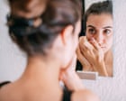 ‘Ferritin face’: are social media claims about iron deficiency fact – or fiction?