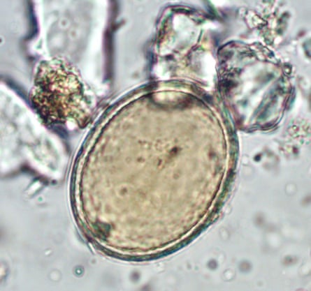A roundworm egg recovered from a grave at All Saints by the Castle parish cemetery.