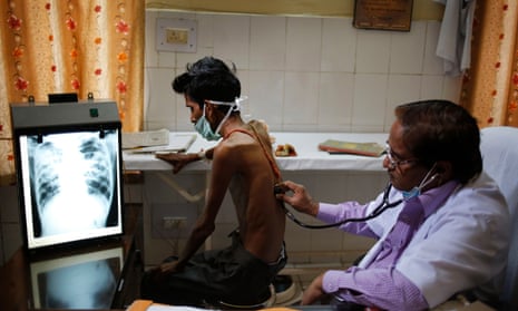 An Indian doctor examines a tuberculosis patient in a government TB hospital in Allahalabad, India.