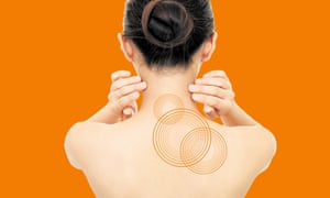 Neck fix … the VNS implant sends out weak electrical pulses.