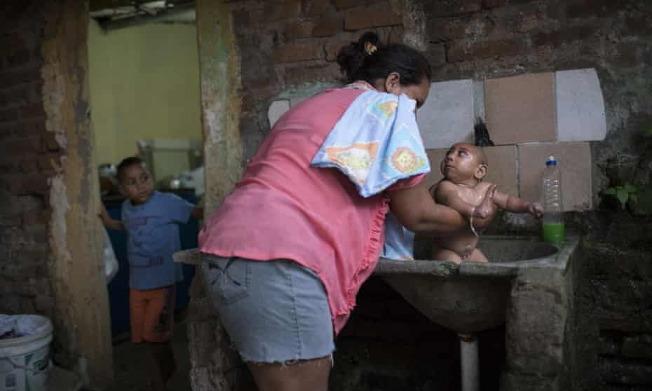 Solange Ferreira bathes her son, who has microcephaly, in a sink in their house in Bonito, Pernambuco state, Brazil. 