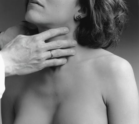 A shirtless woman has her neck inspected by two hands.