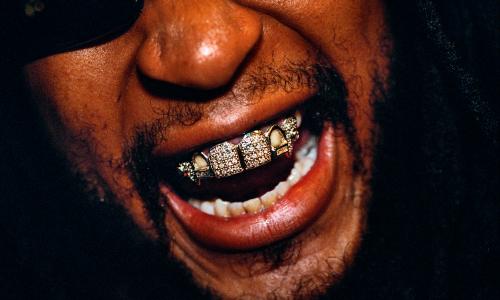 Mouth full of bling: Lil Jon’s diamond dentistry.