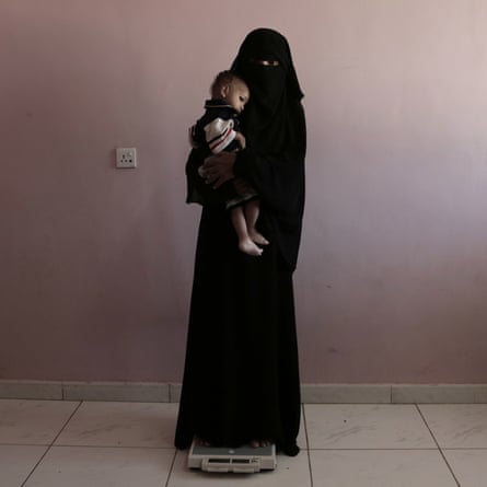 Umm Mizrah, 25, holds her son Mizrah on a scale at al-Sadaqa hospital in Aden, Yemen