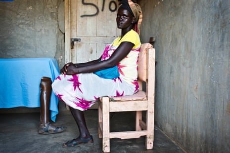 Achol, whose leg was shot and then amputated in South Sudan, waits to have her prosthetic foot replaced in Kakuma Camp for refugees, Kenya