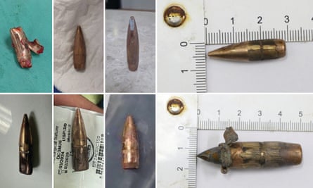 Bullets taken from people shot in Gaza 2025.