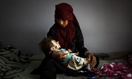 Halima Yehia, from Damar, holds her granddaughter Qasima in the malnutrition ward of the al-Sabeen hospital