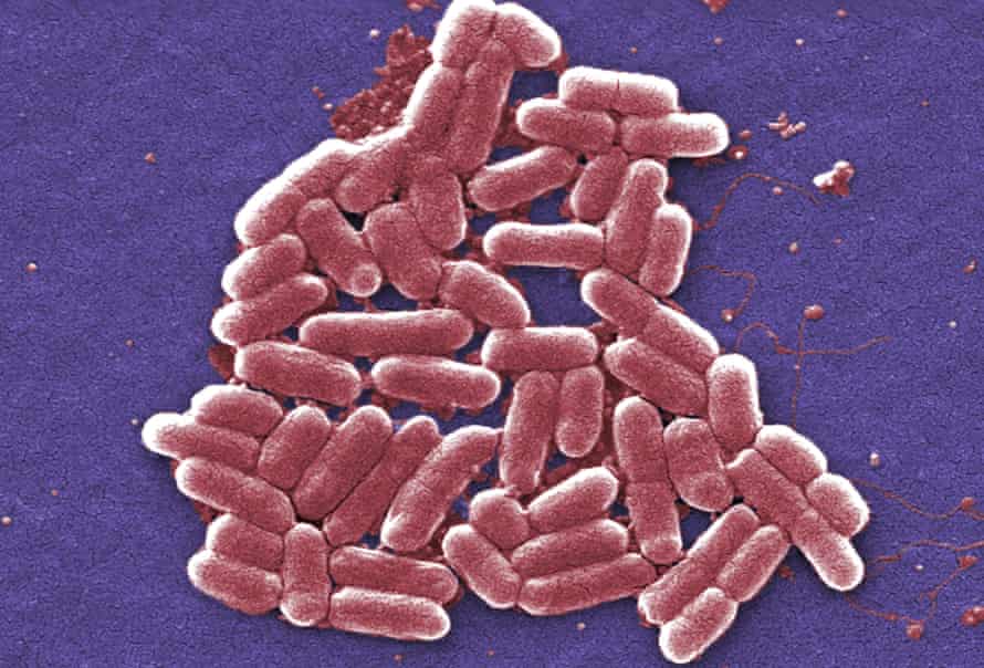 A micrograph image of the O157:H7 strain of E coli bacteria.