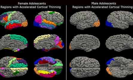 Brain scans from female and male adolescents