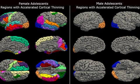 Brain scans from female and male adolescents