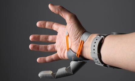 Robotic thumb