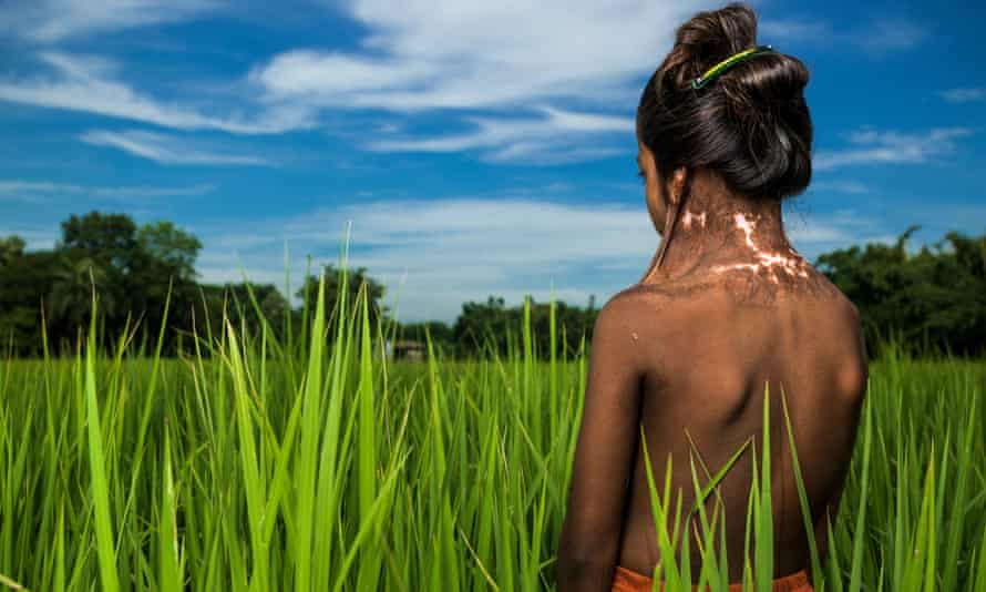Brent Stirton Burns Capital of the World