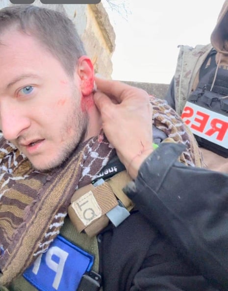 Italian journalist wounded by Russian artillery.
