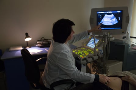 Dr Gayane Avetisyan performs an ultrasound on a pregnant patient at the Republican Maternity Hospital in Yerevan