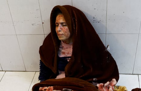 A wounded Palestinian woman sits on the floor in Nasser hospital following Israeli strikes in Khan Younis in the southern Gaza Strip.