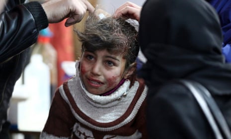Hala, 9, receives treatment at a makeshift hospital in besieged eastern Ghouta.