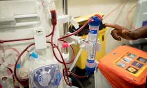 A dialysis machine