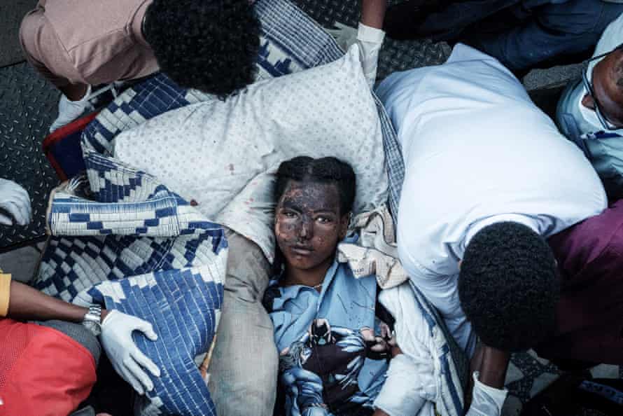 An injured resident of Togoga, a village about 20km west of Mekele, arrives on a stretcher to the Ayder referral hospital in Mekele, the capital of Tigray region, Ethiopia, on June 23, 2021, a day after a deadly airstrike on a market in Ethiopia’s war-torn northern Tigray region, where a seven-month-old conflict surged again