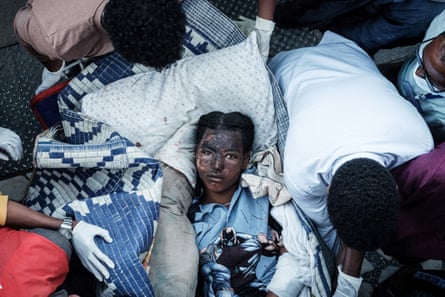 An injured resident of Togoga, a village about 20km west of Mekele, arrives on a stretcher to the Ayder referral hospital in Mekele, the capital of Tigray region, Ethiopia, on June 23, 2021, a day after a deadly airstrike on a market in Ethiopia’s war-torn northern Tigray region, where a seven-month-old conflict surged again