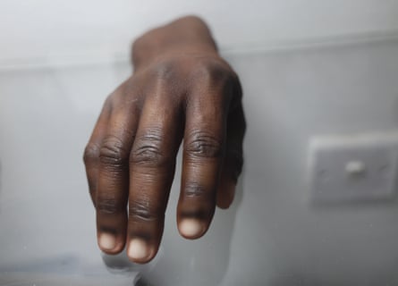 A lifelike prosthetic of a hand of a black person