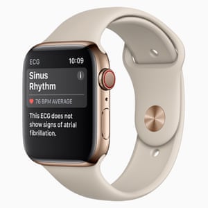 The new watch has an ECG sensor to detect the wearerâs heart rhythm as well as heart rate.
