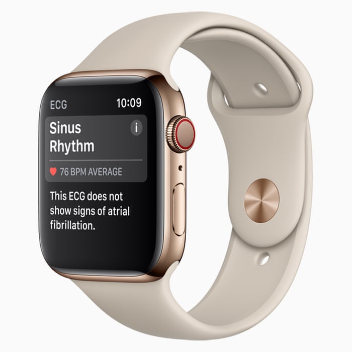 Apple watch compatible with iphone xs max Clearance