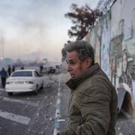A shocked-looking middle-aged man with blood dripping down the side of his face